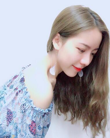 北京藝星王英勇隆鼻案例 隆鼻整形三個(gè)月