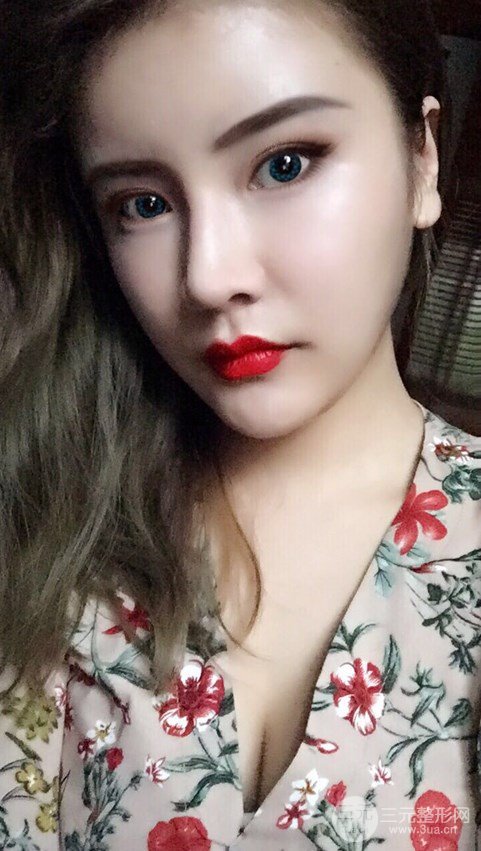 淄博陽(yáng)光整形自體脂肪隆胸前后對(duì)比圖,真實(shí)案例