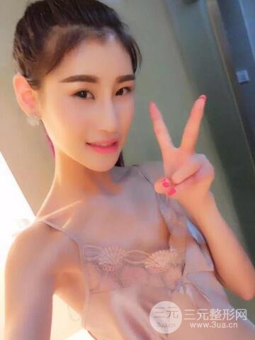 曼托假體+自體脂肪豐胸前后對(duì)比 重慶軍美打造果凍胸