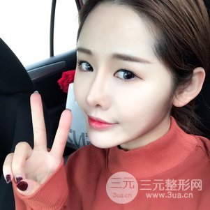 南京米尚恩陳天杰自體脂肪填充全臉 女神的養(yǎng)成記!