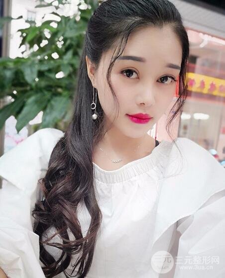 鼻頭縮小術過程圖，鼻頭縮小恢復日記