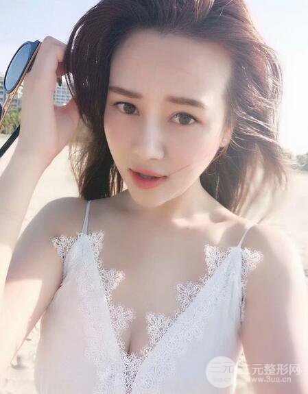 【高強(qiáng)度聚焦超聲面b提升術(shù)后照片】原來我的青春并沒有走遠(yuǎn)~