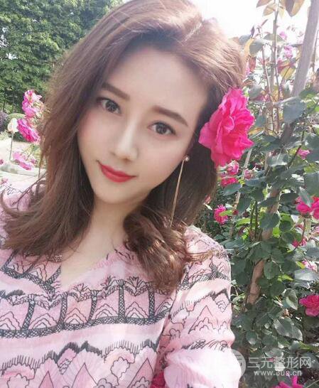 【高強(qiáng)度聚焦超聲面b提升術(shù)后照片】原來我的青春并沒有走遠(yuǎn)~