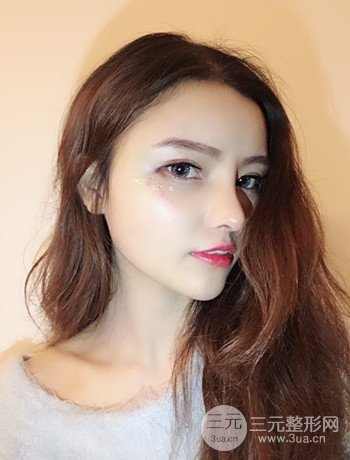 全臉自體脂肪填充+隆鼻整形果永.久保持、丑小鴨變天鵝不是夢