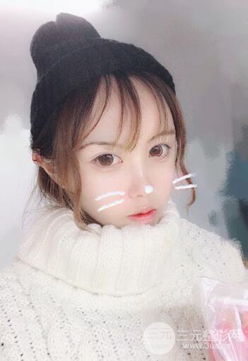 自體脂肪填充全臉基本換臉，改臉型不只是磨骨才能做到！