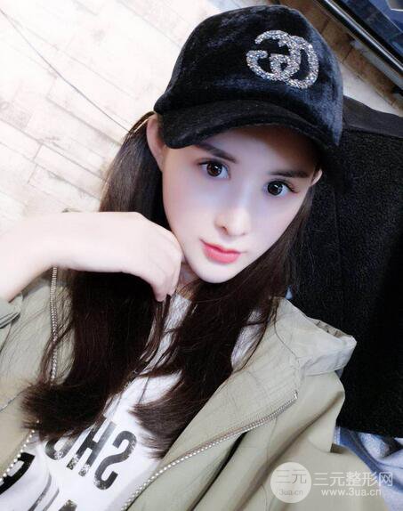 隆鼻失敗修復(fù)