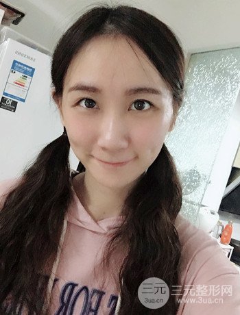 面部埋埋蛋白線.提升改良皮膚松弛，立現(xiàn)小V臉