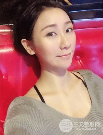 面部埋埋蛋白線.提升改良皮膚松弛，立現(xiàn)小V臉