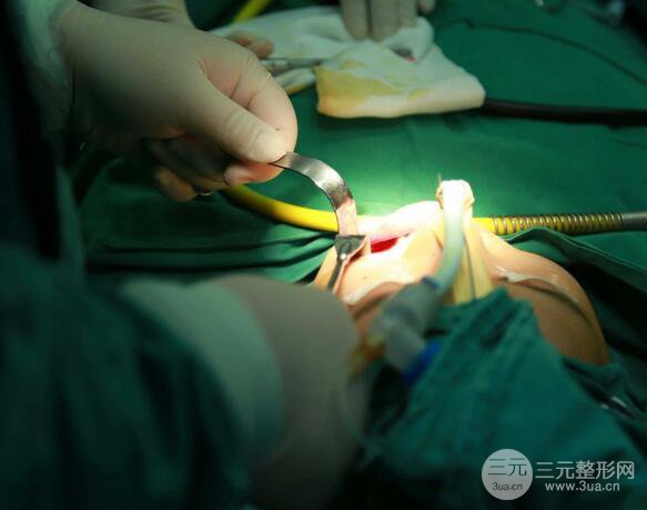 【下頜角+顴骨+下巴】全臉磨骨整形