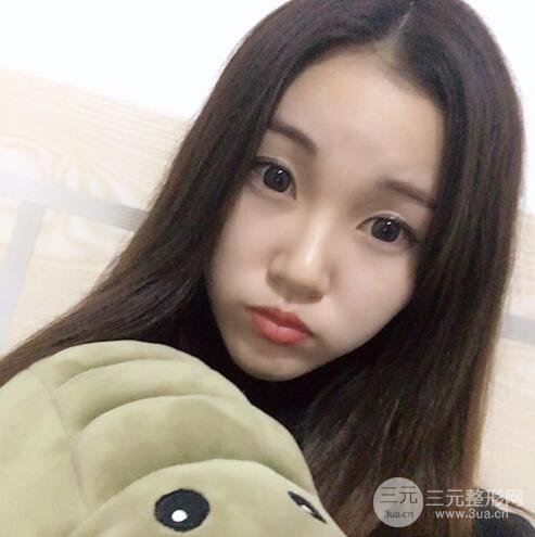 下頜角磨骨整形全過程分享，附上術后恢復照片~