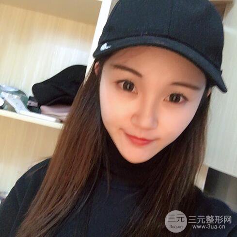 下頜角磨骨整形全過程分享，附上術后恢復照片~