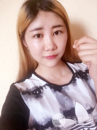 深圳臻希美詳細部自體脂肪填充果對比超明X