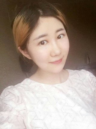 深圳臻希美詳細部自體脂肪填充果對比超明X