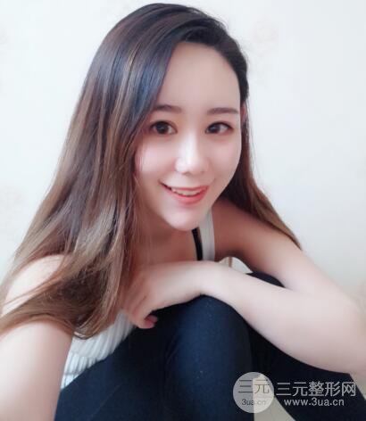 全臉自體脂肪填充,填充不飽滿還可以瘦臉_真人案例