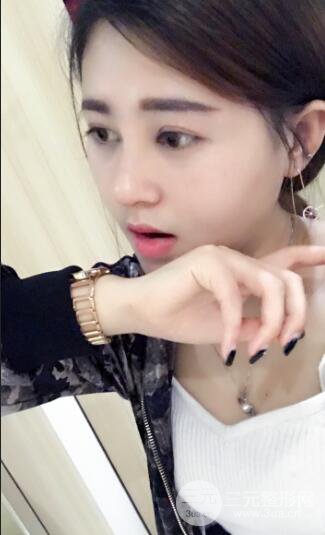 膨體隆鼻術(shù)后恢復(fù)果圖_全過程解密