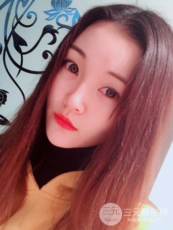 濟(jì)南硅膠假體墊下巴真人案例、下巴改變整個(gè)臉型