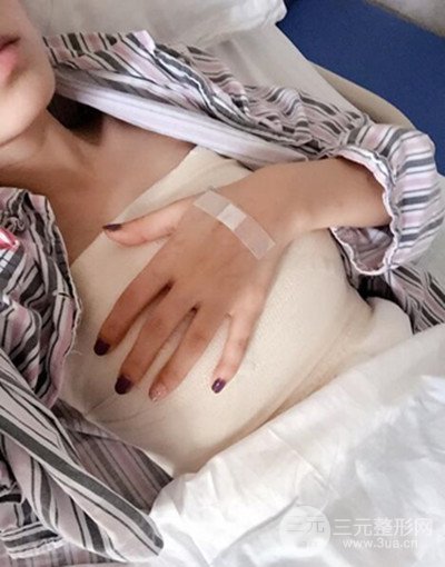 假體隆胸手術恢復記錄，豐滿大胸不是夢