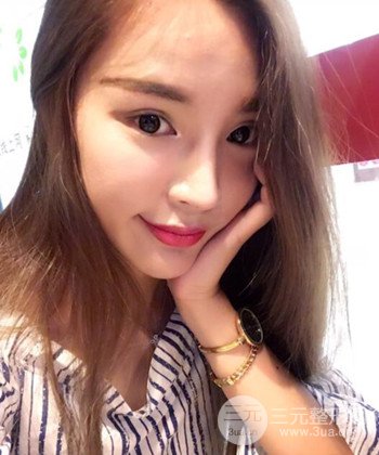 模特做隆鼻整形真實日記分享，附上恢復(fù)過程圖