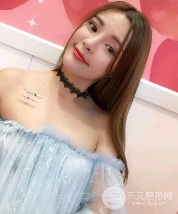 模特做隆鼻整形真實日記分享，附上恢復(fù)過程圖