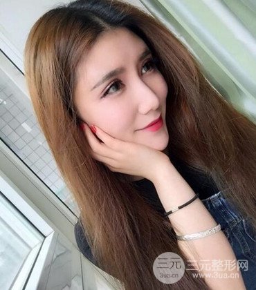 網(wǎng)絡(luò)主播做自體脂肪豐太陽穴真實案例分享，果杠杠的