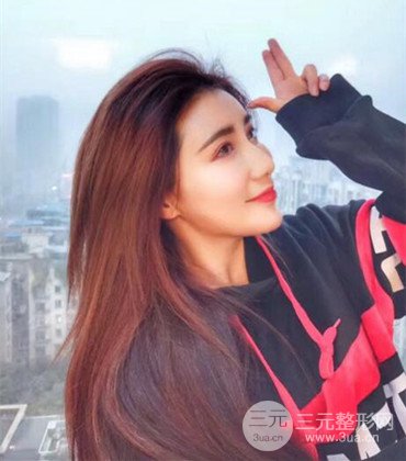 網(wǎng)絡(luò)主播做自體脂肪豐太陽穴真實案例分享，果杠杠的