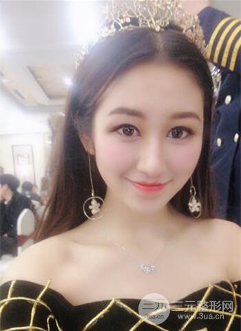 廣州隆鼻整形真實恢復(fù)期圖片,擁有精致美鼻不是夢