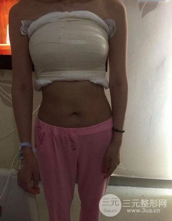 上海假體隆胸真人日記手術果分享，從A到D不是夢