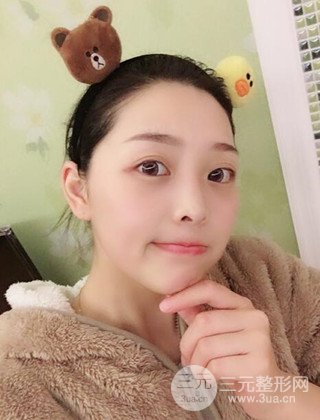 面部吸脂瘦臉手術(shù)日記分享,瘦臉果驚人