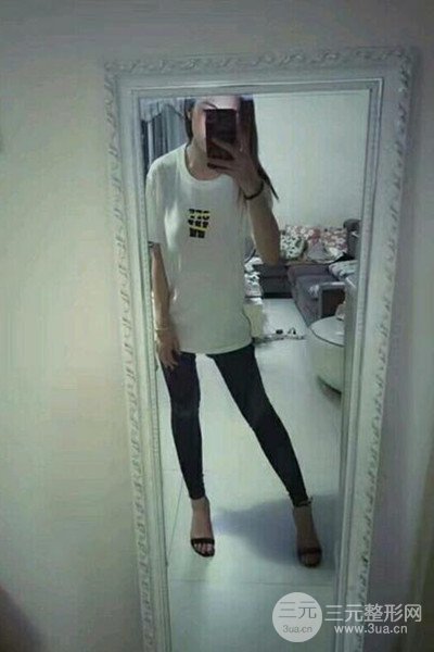 梨型身材做了大腿吸脂之后果超明X,吸脂恢復(fù)過(guò)程分享