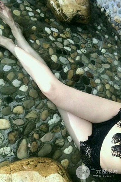 梨型身材做了大腿吸脂之后果超明X,吸脂恢復(fù)過(guò)程分享