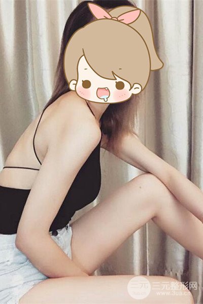 梨型身材做了大腿吸脂之后果超明X,吸脂恢復(fù)過(guò)程分享