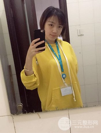 北京內(nèi)切祛眼袋真人案例果對比分享，年輕十歲不是夢