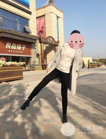 吸脂瘦大腿手術(shù)經(jīng)歷分享，纖細(xì)雙腿不再是夢(mèng)