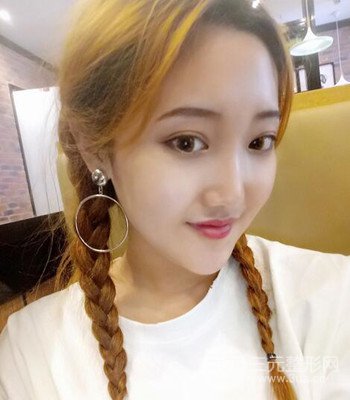 終于做了下頜角整形，分享術(shù)后恢復(fù)果