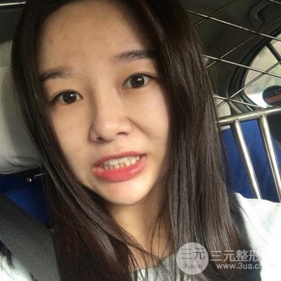 做了牙齒冷光美白果很棒，綻放美麗笑容