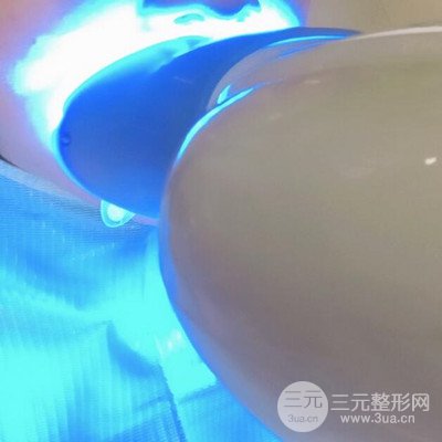 做了牙齒冷光美白果很棒，綻放美麗笑容