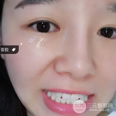 做了牙齒冷光美白果很棒，綻放美麗笑容