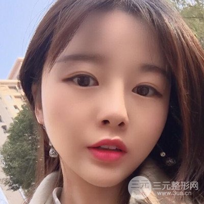做了牙齒冷光美白果很棒，綻放美麗笑容