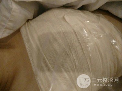 平胸妹做了假體隆胸果分享，豐滿(mǎn)身材不是夢(mèng)