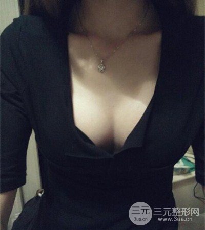 平胸妹做了假體隆胸果分享，豐滿(mǎn)身材不是夢(mèng)