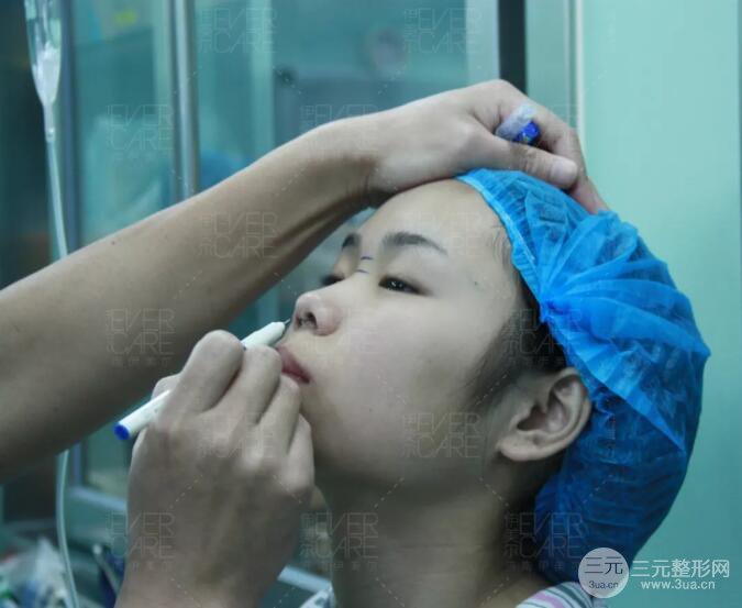 北京伊美爾徐軍假體隆鼻前后對(duì)比照片心情日記