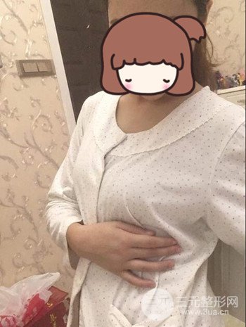 假體隆胸術(shù)后成功擺脫小學(xué)生身材，立現(xiàn)性感身材