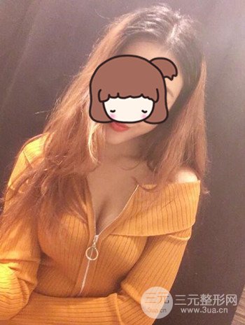 假體隆胸術(shù)后成功擺脫小學(xué)生身材，立現(xiàn)性感身材