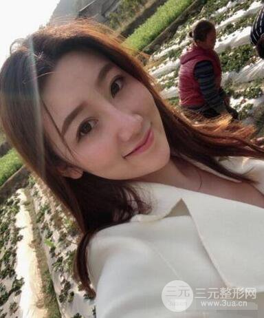 北京伊美爾徐軍隆鼻整形前后對比照片心情記錄小札