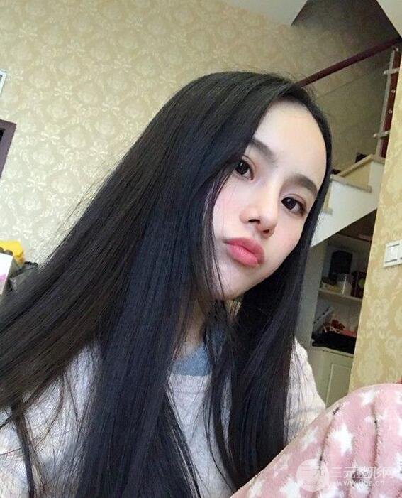 成都大華隆鼻怎么樣?真實(shí)案例前后對(duì)比圖記錄恢復(fù)過程