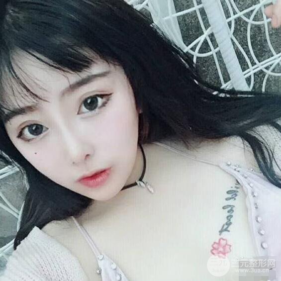 合肥壹加壹甘泉涌軟骨隆鼻前后對比圖|內(nèi)附真人案例恢復(fù)前過程