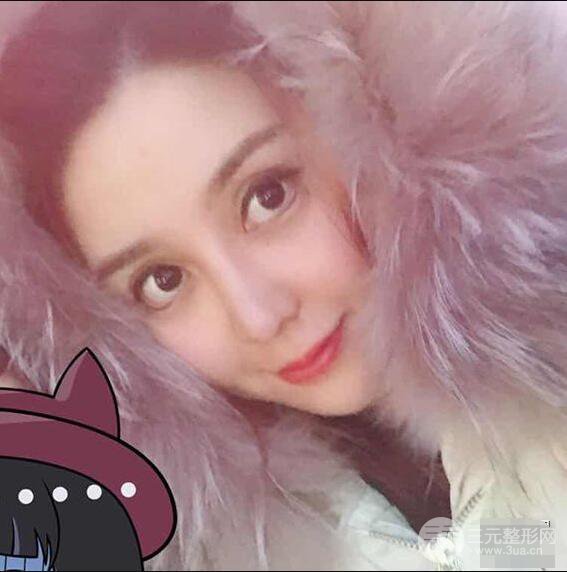 昆明吳氏嘉美李明硅膠隆鼻前后對比圖恢復心情小札