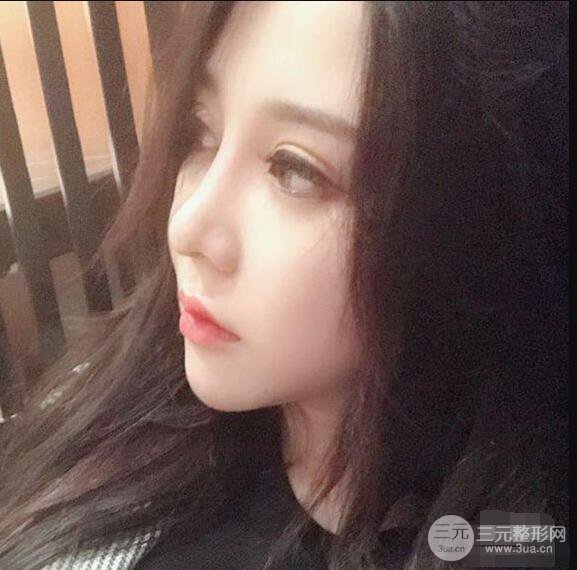 昆明吳氏嘉美李明硅膠隆鼻前后對比圖恢復心情小札