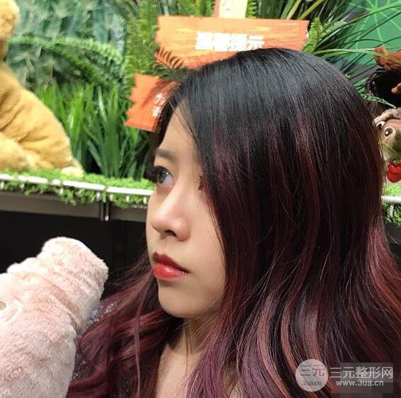 重慶華美何春濤硅膠隆鼻前后對比圖 內(nèi)附恢復(fù)心情小札