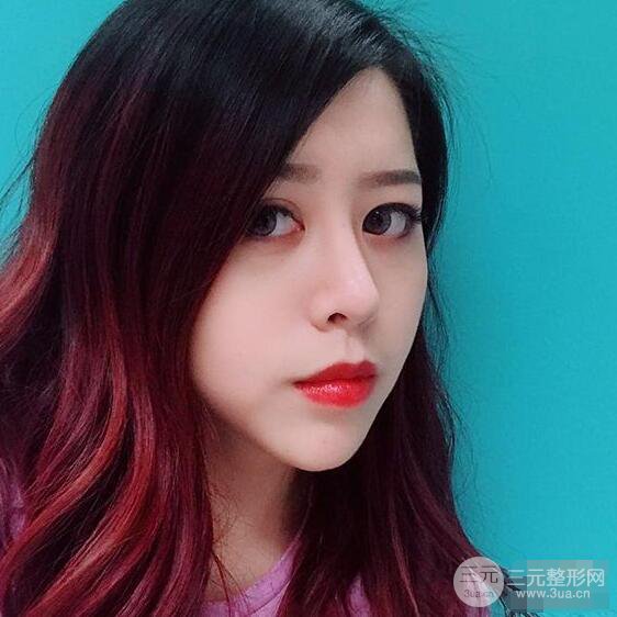 重慶華美何春濤硅膠隆鼻前后對比圖 內(nèi)附恢復(fù)心情小札